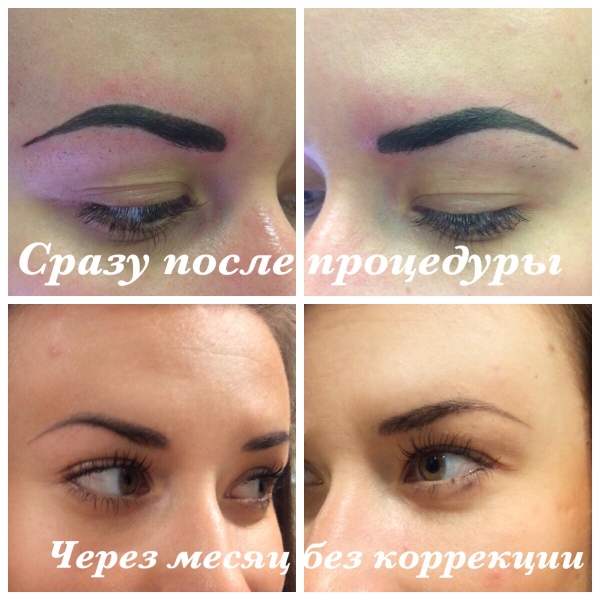 Брови
